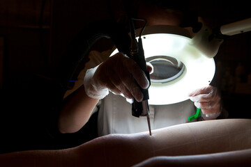 Laser hair removal session in a beauty salon.