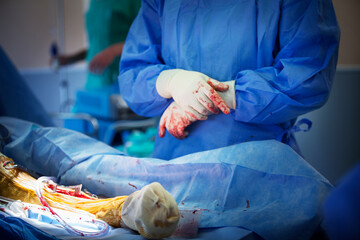 Orthopedic surgery operating room for the removal of external.