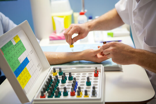 Allergological skin tests carried out by an allergist allergen kit.