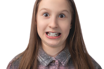 A cheerful cute girl with an orthodontic appliance makes faces on a white background. The concept of teeth alignment in childhood. Studio photo on a white background.