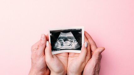 Ultrasound image pregnant baby photo. Woman hands holding ultrasound pregnancy picture on pink...