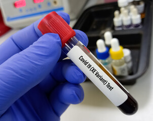 Blood sample for Covid-19 New Variant Omicron XE test. Which is more transmission able then omicron...