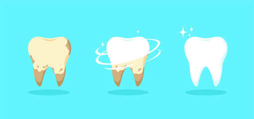 Set of teeth on blue background. Vector illustration of cleaning stage or whitening from unhealthy to healthy teeth, hygiene, caries protection, going to the dentist in cartoon style.