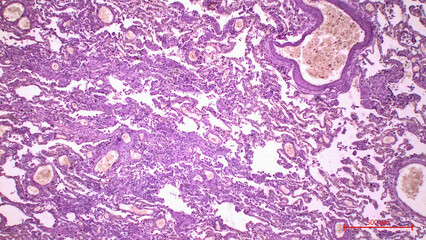 Histopathological data of the lungs in COVID-19 disease. Summary of histopathological features...