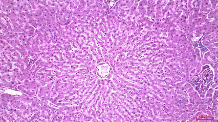 Light micrograph of a human liver stained with hematoxylin and eosin. The hepatocytes are arranged in cords separated by clear areas where hepatic sinusoids showing red blood cells are located.