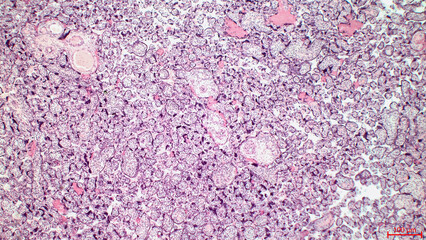 Human placenta with chorionic villi, blood vessels and red blood cells. Hematoxylin and Eosin Staining.