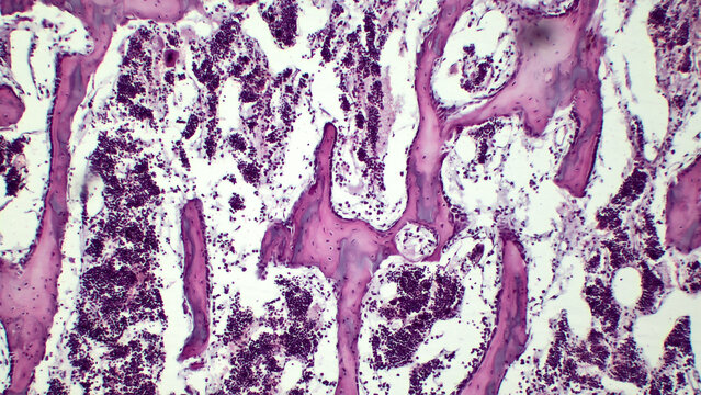 Human red bone marrow, hematopoietic press. The big tsit beetveen erythrocytes are megakaryocytes. Hematoxylin and eosin stain. 