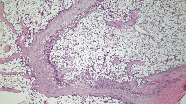 Light micrograph of red bone marrow, showing active haemopoietic tissue (purple, pink) and adipocytes (white spaces). Hematoxylin and eosin stain. 