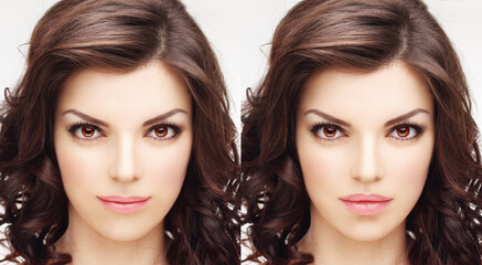 Beauty injections.Concept of rejuvenation.Lip augmentation