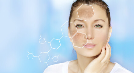 Dark spots, freckles,hyperpigmentation(melasma or chloasma),concept - skin lightening, skin...