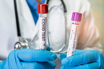 Positive blood infection sample in test tube for omicron covid19 coronavirus in lab. Scientist...
