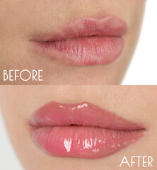 Collage with photos of young woman before and after permanent lip makeup, closeup - obrazy, fototapety, plakaty