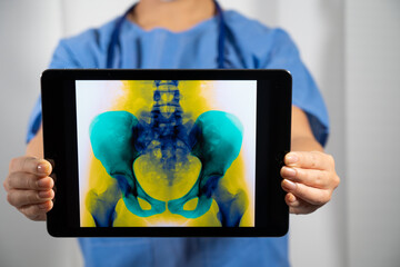 Female doctor holding a screen with x-ray of the pelvis.