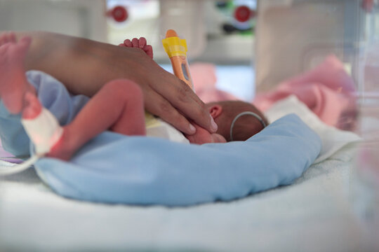 Neonatal department. Medicine neonatology premature baby