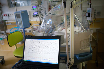 The control electroencephalogram on premature babies.