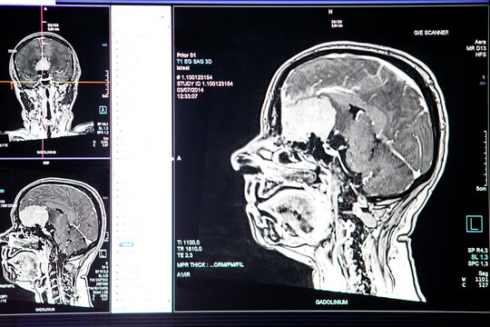 Brain images obtained by MRI in a radiology department of a hospital.