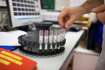 Automated analysis in the analysis laboratory of a hospital.
