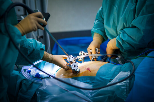Hysterectomy in the operating room with a robot surgeon.