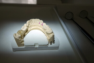 Zahnmodell eines Unterkiefers mit einer Krone