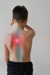 naked back of boy, child 8-10 years old, curved spine, red spot as symbol of pain in spine, concept...