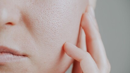 skin with enlarged pores. Part of the face with problem skin