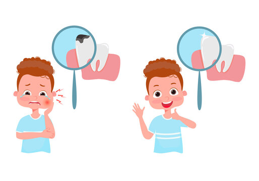 The Concept Of Dental Caries Treatment. Crying Boy With Pain Before Treatment And Happy After Treatment. Under Magnifying Glass Tooth With Caries And Healthy Tooth. Vector Illustration