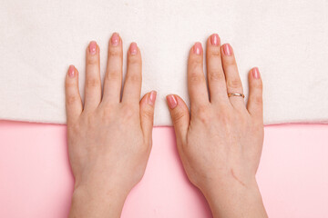 the hands of a girl with nails well-groomed and untidy and regrown with gel polish and covered with gel polish.