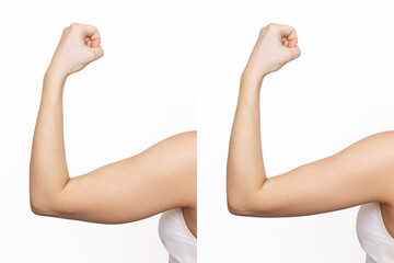 Two shots of a young woman with excess fat on her arm and toned arm before and after losing weight isolated on a white background. Result of diet, liposuction, training. Plastic surgery concept - obrazy, fototapety, plakaty