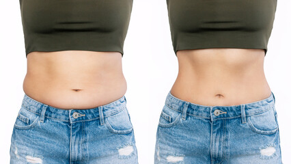 Two shots of a woman's belly with excess fat and toned slim stomach  before and after losing weight isolated on a white background. Result of diet, liposuction, training. Healthy lifestyle - obrazy, fototapety, plakaty
