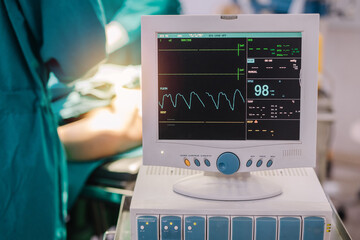 Monitor screen for a medical defibrillator or emergency heart pump, showing vital signs, heart rate, slow beating pulse of a dying coma patient in a hospital ICU room