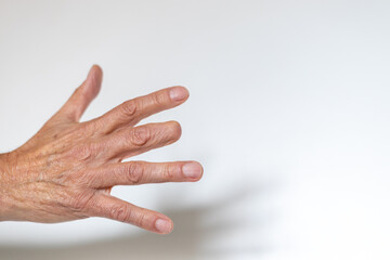 Man’s right hand with amputated middle finger on white background