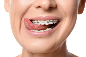Woman with dental braces showing tongue on white background, closeup