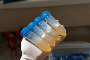 slants with agar for research. Mycology and cultivation of fungi.