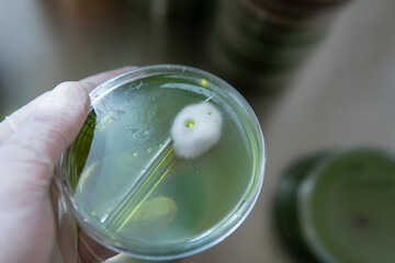 mycelium of exotic mushrooms in petri dishes. Selection and cultivation of mycelium. Mushroom cultivation around the world