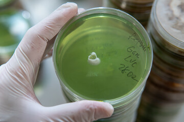 petri dishes with agar. Mycology and mycelium