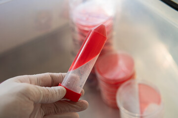 slants with agar for research. Mycology and cultivation of fungi.