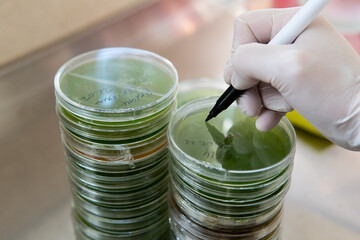 Selection and cultivation of mycelium. Mushroom cultivation around the world