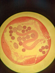 photo of faltworm tissue under the miccoscope