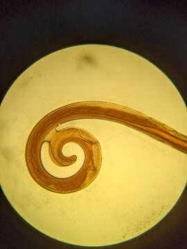 photo of faltworm tissue under the miccoscope