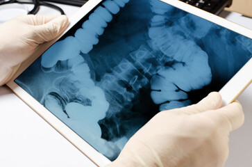 X-ray image of the intestine in the tablet. Gadget in the hands of the doctor close-up. The concept...