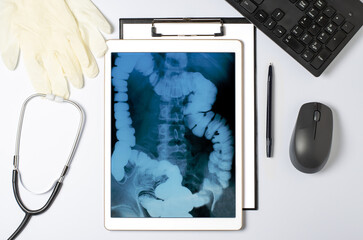 X-ray image of the gastrointestinal tract in a tablet. The concept of telemedicine and diagnosis of diseases