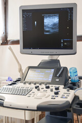 Medical examination of veins on ultrasound sensor in modern technology clinic