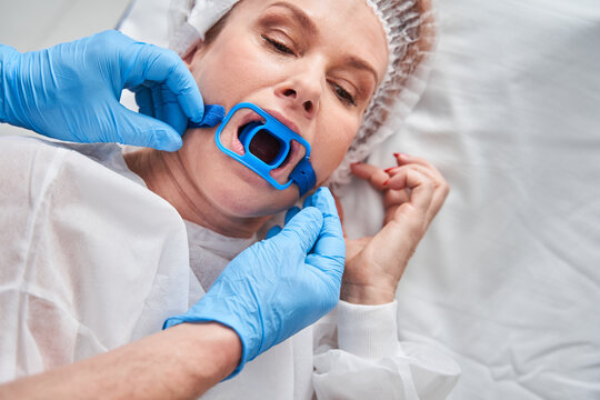 Caucasian woman with special hollow at the mouth during the endoscopy at the hospital