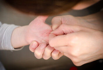 A woman takes a splinter out of a child's hand with a needle. A splinter in a child's hand