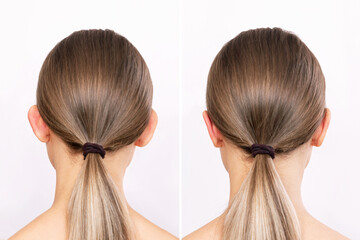 Rear view of a woman's head with ears before and after otoplasty isolated on a white background....