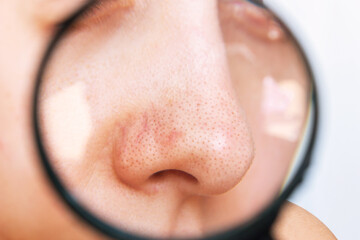 Close-up of a female nose with blackheads or black dots in a magnifying glass isolated on a white...
