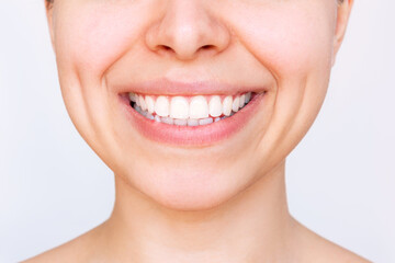 Cropped shot of a young caucasian smiling woman with perfect white even teeth isolated on a white...