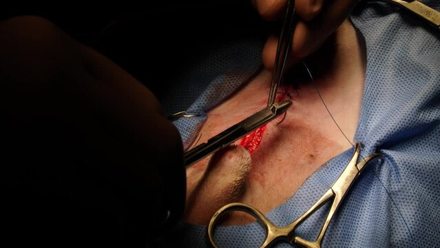 ペットの開腹手術の縫合シーン