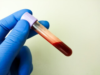 Hand holding blood sample in vacuum tube for pathological analysis.