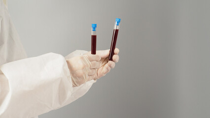Hands are holding two blood test tubes on grey background. Hand wears a PPE suit and a white medical glove.
